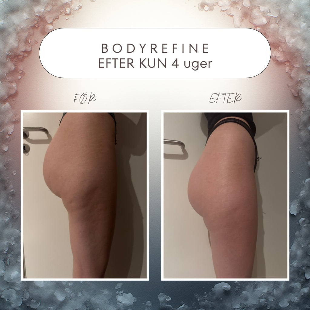 GrayLuxe™ BodyRefine Original